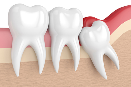 Dentiste Truchtersheim
